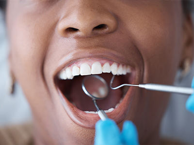 Rooted Dental Company | Intraoral Camera, Dentures and Digital Radiography