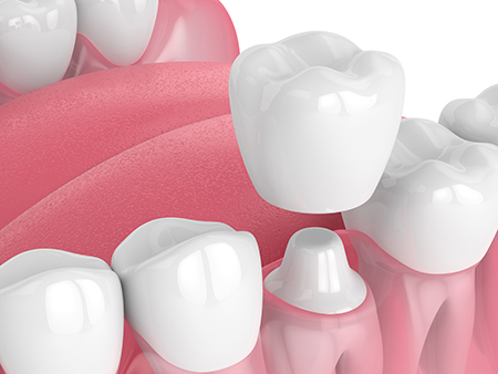 Rooted Dental Company