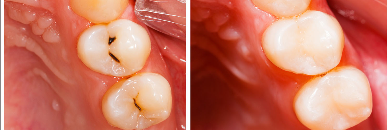 Rooted Dental Company