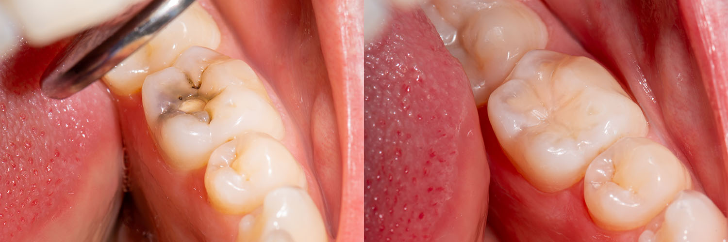 Rooted Dental Company