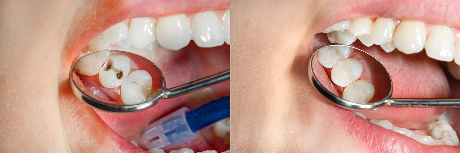 Rooted Dental Company